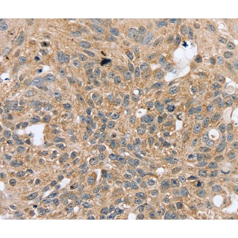 Immunohistochemistry - RASGEF1A Antibody from Signalway Antibody (40070) - Antibodies.com