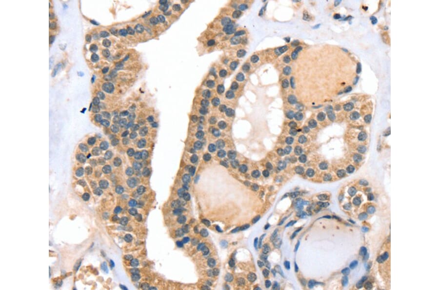 Immunohistochemistry - RASGEF1A Antibody from Signalway Antibody (40070) - Antibodies.com
