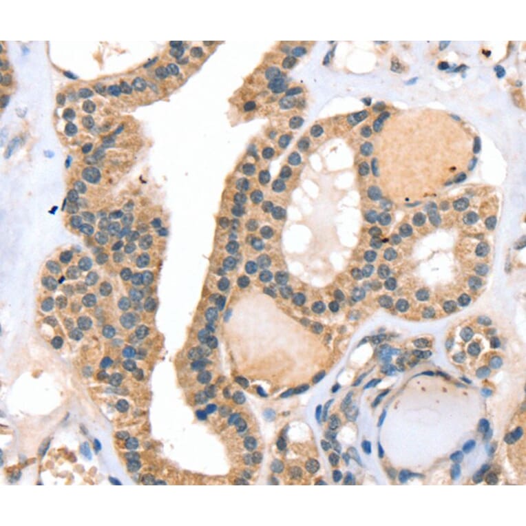 Immunohistochemistry - RASGEF1A Antibody from Signalway Antibody (40070) - Antibodies.com