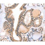 Immunohistochemistry - RASGEF1A Antibody from Signalway Antibody (40070) - Antibodies.com