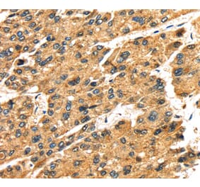 Immunohistochemistry - SLC25A26 Antibody from Signalway Antibody (40108) - Antibodies.com