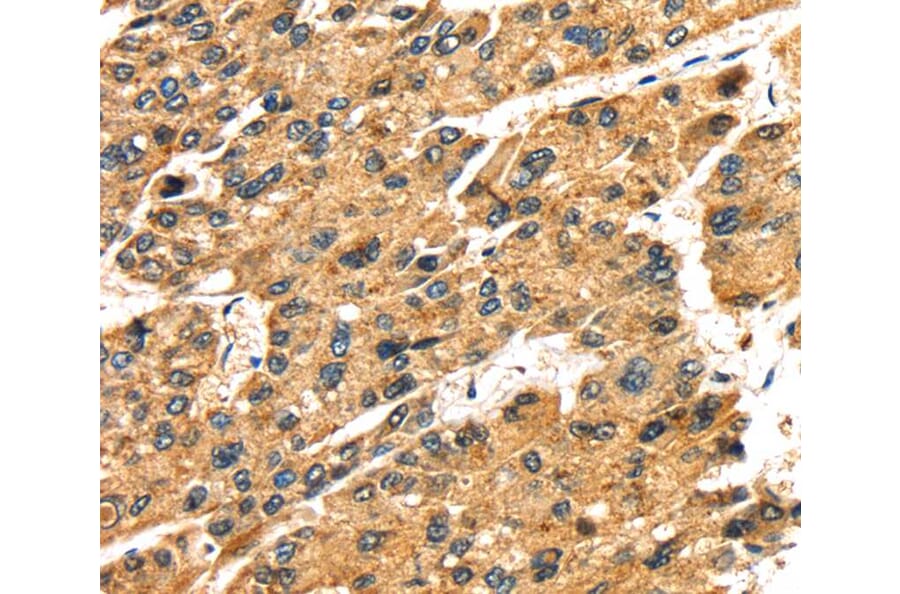 Immunohistochemistry - SLC25A26 Antibody from Signalway Antibody (40108) - Antibodies.com