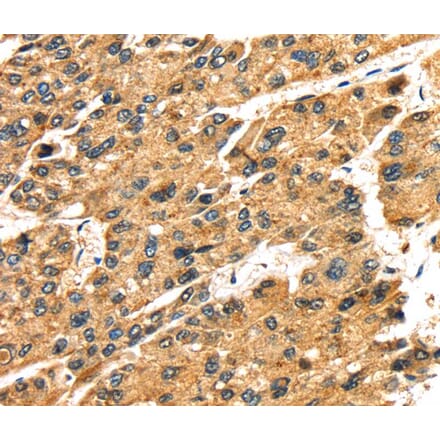 Immunohistochemistry - SLC25A26 Antibody from Signalway Antibody (40108) - Antibodies.com