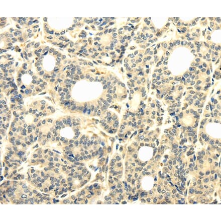 Immunohistochemistry - TBC1D22A Antibody from Signalway Antibody (40135) - Antibodies.com