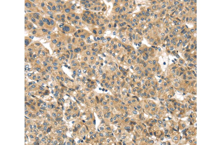 Immunohistochemistry - TMEM161A Antibody from Signalway Antibody (40157) - Antibodies.com