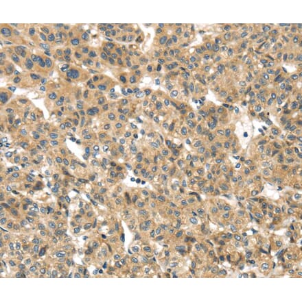 Immunohistochemistry - TMEM161A Antibody from Signalway Antibody (40157) - Antibodies.com