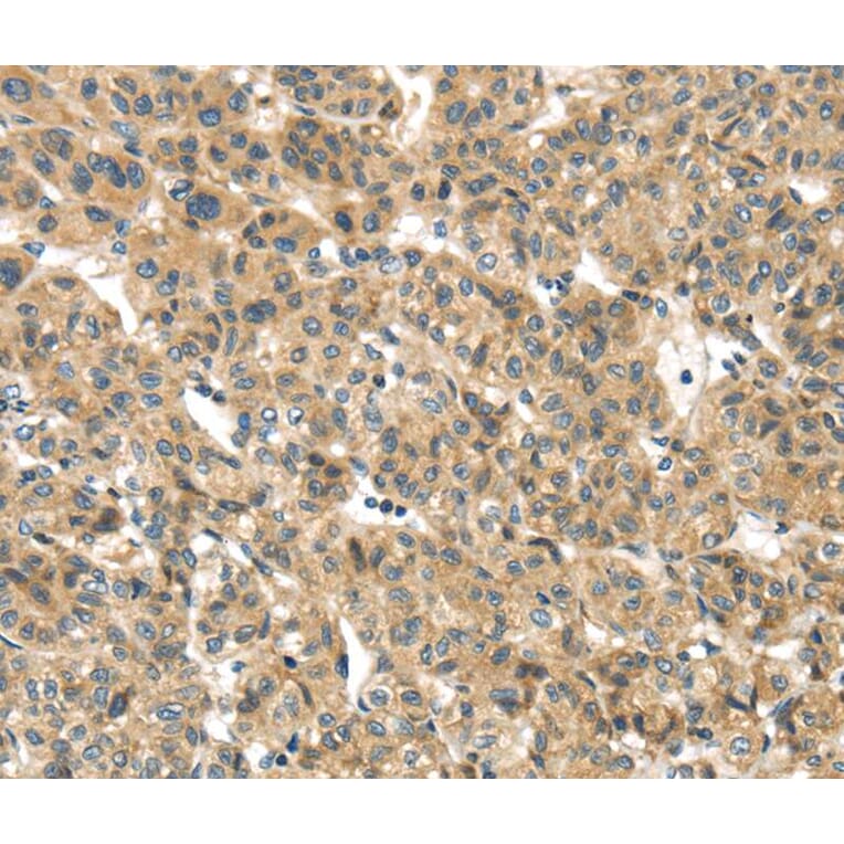 Immunohistochemistry - TMEM161A Antibody from Signalway Antibody (40157) - Antibodies.com