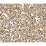 Immunohistochemistry - TMEM161A Antibody from Signalway Antibody (40157) - Antibodies.com