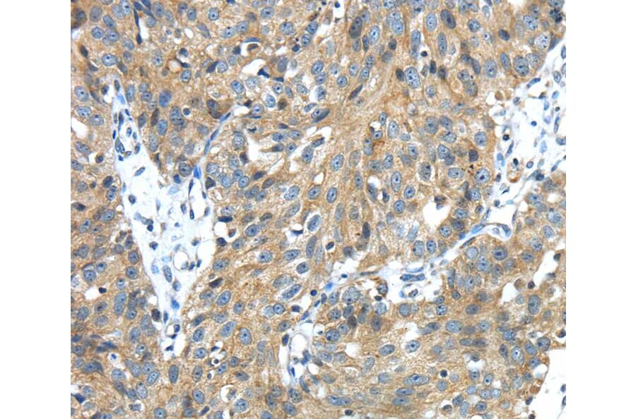Immunohistochemistry - TMPRSS13 Antibody from Signalway Antibody (40159) - Antibodies.com
