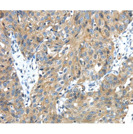 Immunohistochemistry - TMPRSS13 Antibody from Signalway Antibody (40159) - Antibodies.com