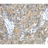 Immunohistochemistry - TMPRSS13 Antibody from Signalway Antibody (40159) - Antibodies.com