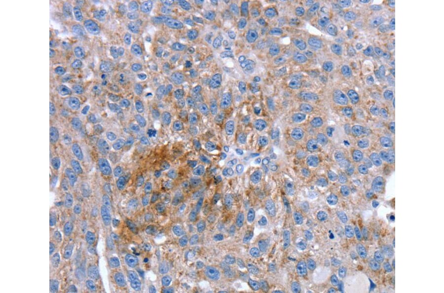 Immunohistochemistry - SPATA5L1 Antibody from Signalway Antibody (40220) - Antibodies.com