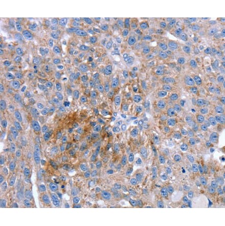 Immunohistochemistry - SPATA5L1 Antibody from Signalway Antibody (40220) - Antibodies.com