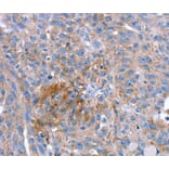 Immunohistochemistry - SPATA5L1 Antibody from Signalway Antibody (40220) - Antibodies.com