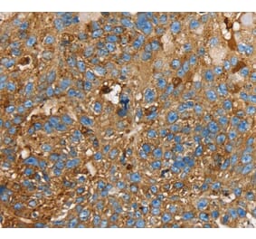 Immunohistochemistry - LGALS3BP Antibody from Signalway Antibody (40312) - Antibodies.com