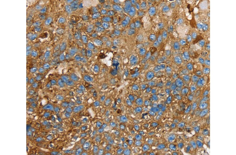 Immunohistochemistry - LGALS3BP Antibody from Signalway Antibody (40312) - Antibodies.com