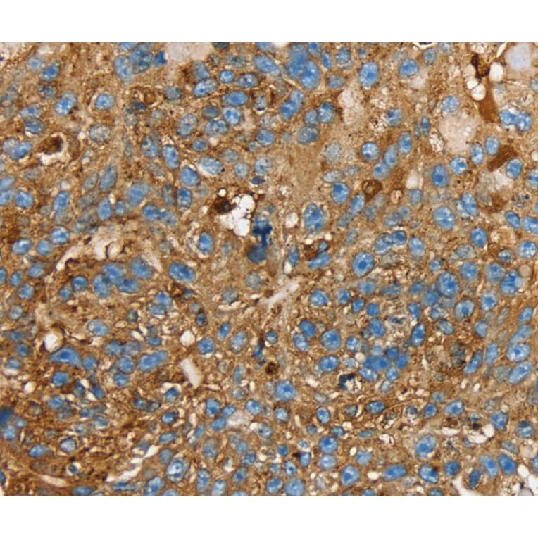 Immunohistochemistry - LGALS3BP Antibody from Signalway Antibody (40312) - Antibodies.com