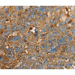 Immunohistochemistry - LGALS3BP Antibody from Signalway Antibody (40312) - Antibodies.com