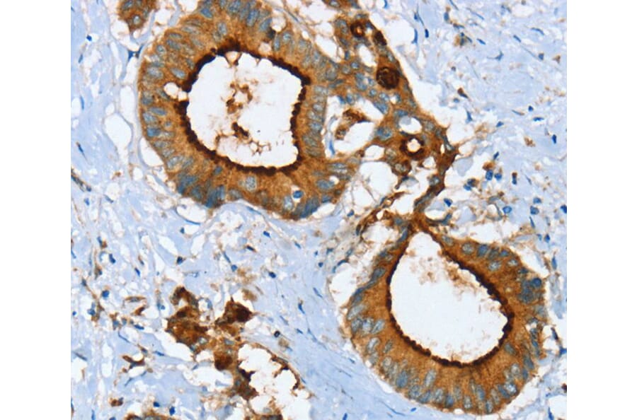Immunohistochemistry - LGALS3BP Antibody from Signalway Antibody (40312) - Antibodies.com