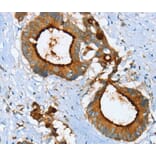 Immunohistochemistry - LGALS3BP Antibody from Signalway Antibody (40312) - Antibodies.com