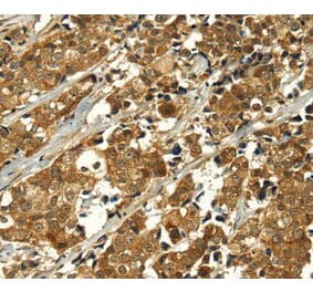 Immunohistochemistry - MAPKAPK5 Antibody from Signalway Antibody (40313) - Antibodies.com