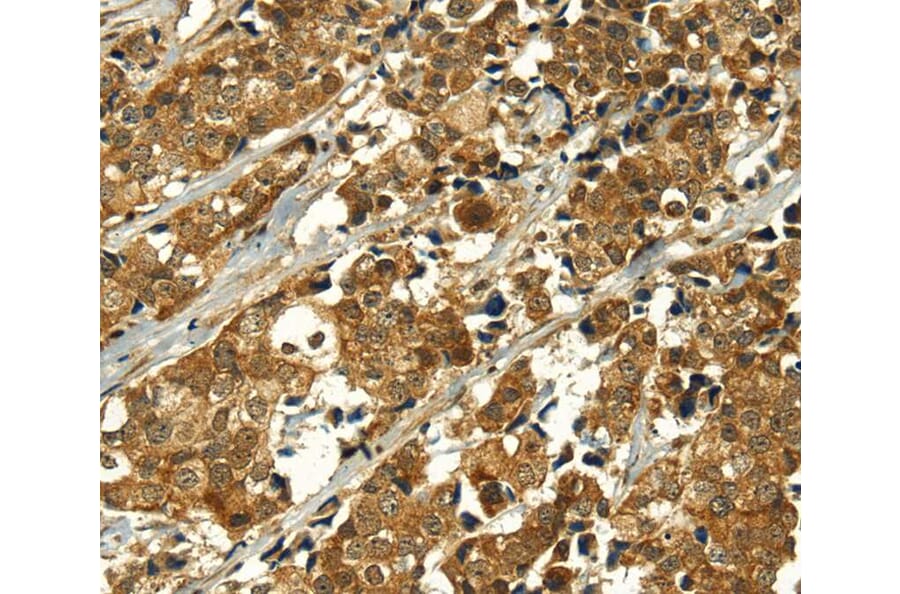 Immunohistochemistry - MAPKAPK5 Antibody from Signalway Antibody (40313) - Antibodies.com