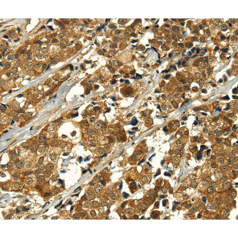 Immunohistochemistry - MAPKAPK5 Antibody from Signalway Antibody (40313) - Antibodies.com