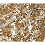 Immunohistochemistry - MAPKAPK5 Antibody from Signalway Antibody (40313) - Antibodies.com
