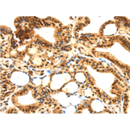 Immunohistochemistry - SERPINB1 Antibody from Signalway Antibody (42752) - Antibodies.com