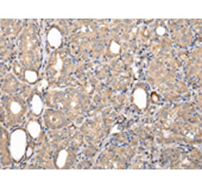 Immunohistochemistry - SERPINA7 Antibody from Signalway Antibody (42780) - Antibodies.com