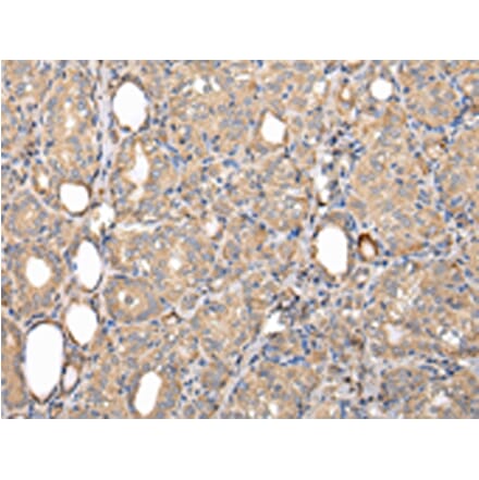 Immunohistochemistry - SERPINA7 Antibody from Signalway Antibody (42780) - Antibodies.com