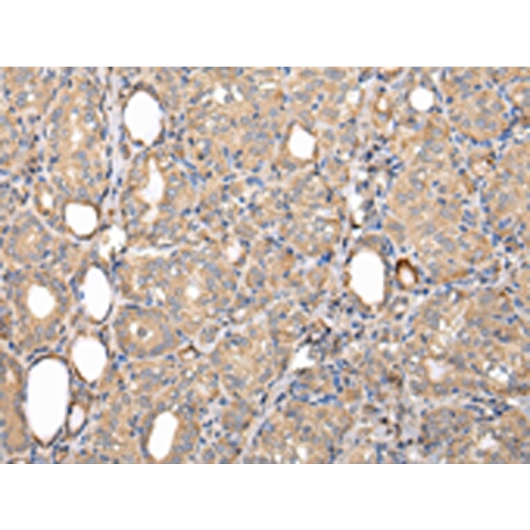 Immunohistochemistry - SERPINA7 Antibody from Signalway Antibody (42780) - Antibodies.com