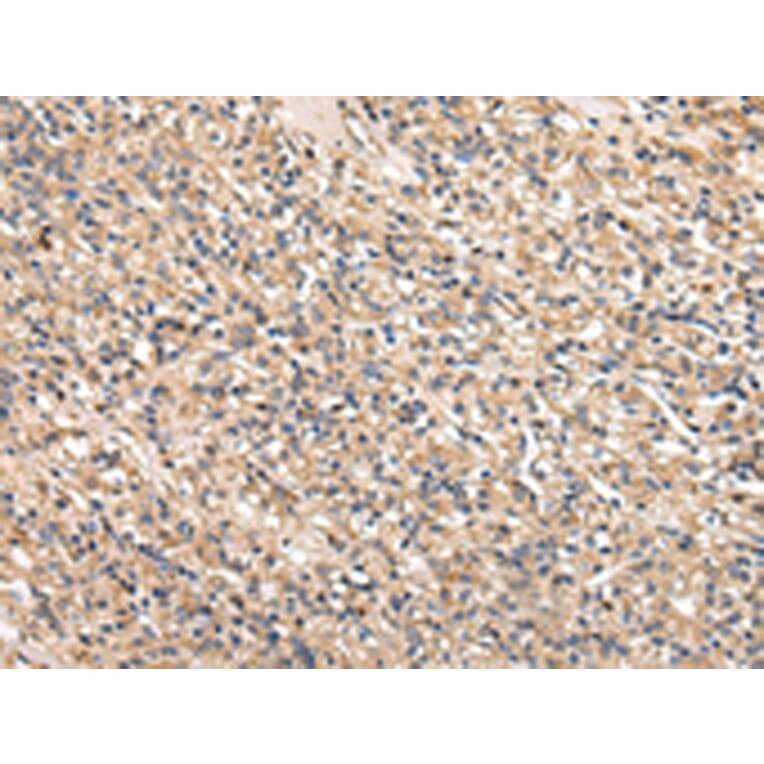 Immunohistochemistry - SERPINA7 Antibody from Signalway Antibody (42780) - Antibodies.com