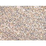 Immunohistochemistry - SERPINA7 Antibody from Signalway Antibody (42780) - Antibodies.com