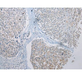 Immunohistochemistry - TRNAU1AP Antibody from Signalway Antibody (42966) - Antibodies.com