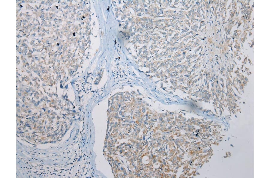 Immunohistochemistry - TRNAU1AP Antibody from Signalway Antibody (42966) - Antibodies.com