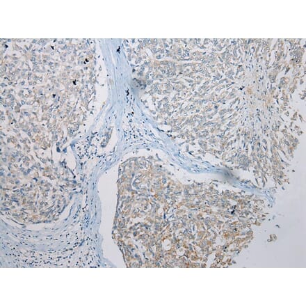 Immunohistochemistry - TRNAU1AP Antibody from Signalway Antibody (42966) - Antibodies.com