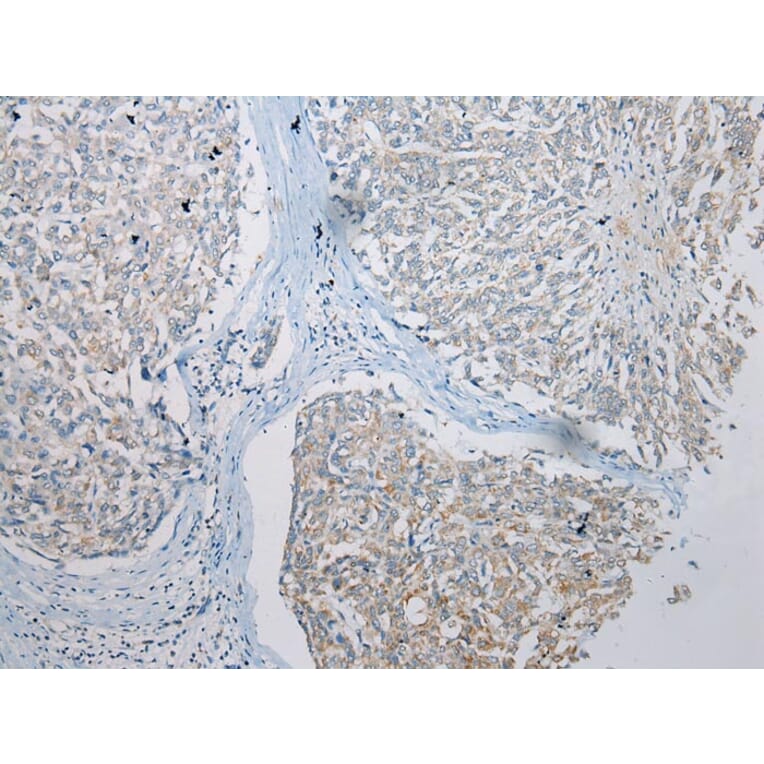 Immunohistochemistry - TRNAU1AP Antibody from Signalway Antibody (42966) - Antibodies.com