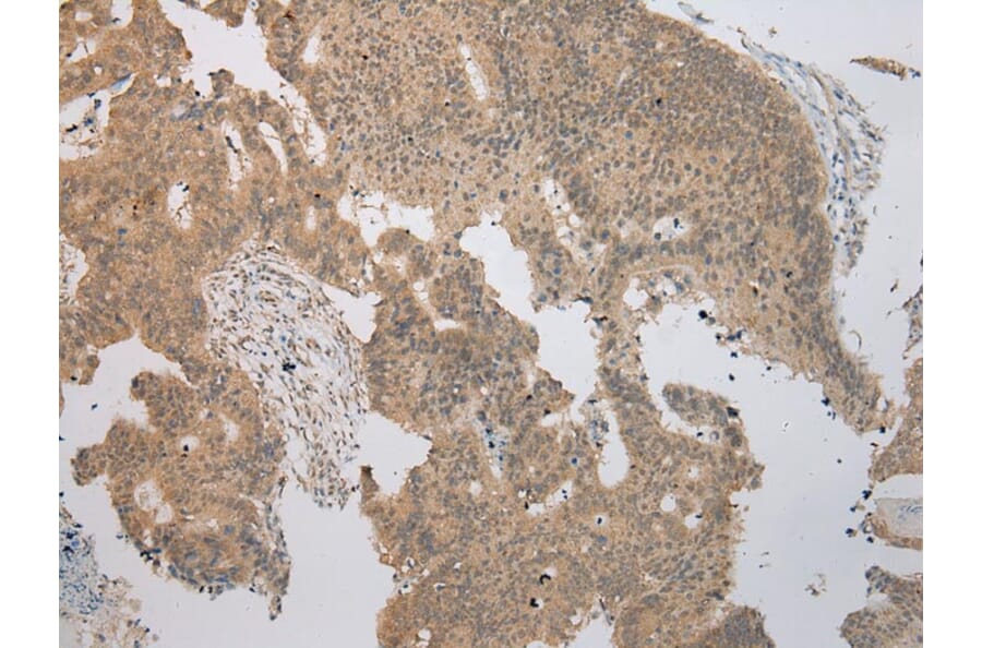 Immunohistochemistry - TRNAU1AP Antibody from Signalway Antibody (42966) - Antibodies.com