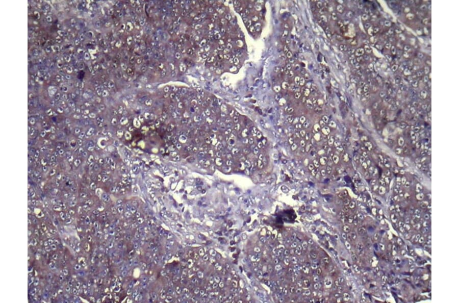 Immunohistochemistry - GLIPR1L1 Antibody from Signalway Antibody (42994) - Antibodies.com
