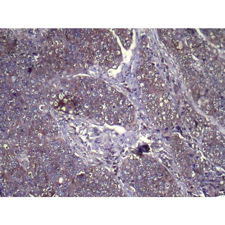 Immunohistochemistry - GLIPR1L1 Antibody from Signalway Antibody (42994) - Antibodies.com