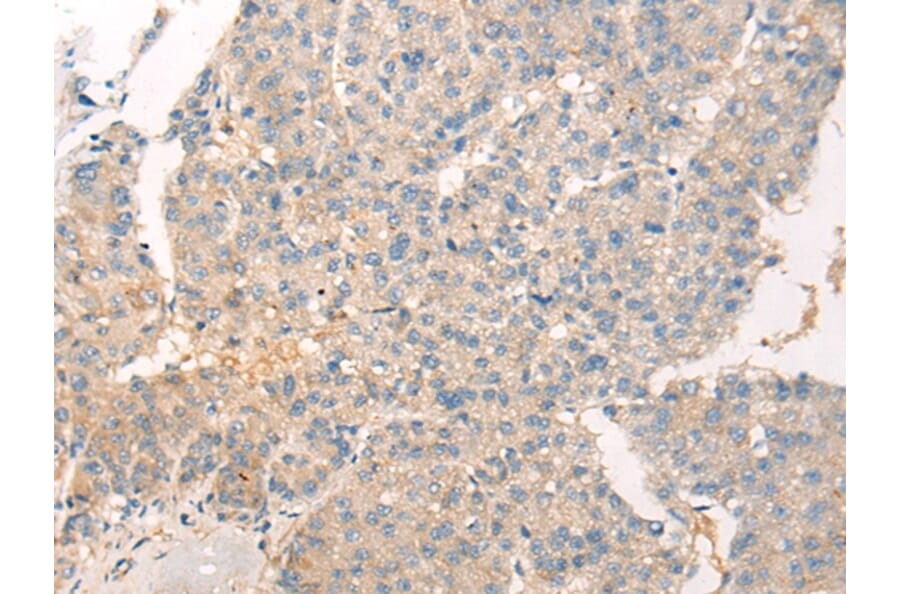 Immunohistochemistry - ADAMTS13 Antibody from Signalway Antibody (43116) - Antibodies.com