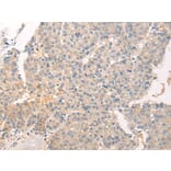 Immunohistochemistry - ADAMTS13 Antibody from Signalway Antibody (43116) - Antibodies.com