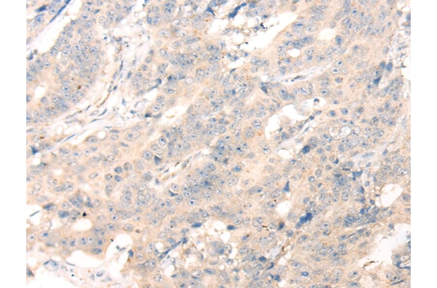 Immunohistochemistry - ADAMTS13 Antibody from Signalway Antibody (43116) - Antibodies.com