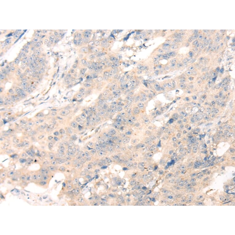 Immunohistochemistry - ADAMTS13 Antibody from Signalway Antibody (43116) - Antibodies.com