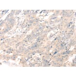 Immunohistochemistry - ADAMTS13 Antibody from Signalway Antibody (43116) - Antibodies.com