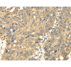 Immunohistochemistry - UHRF1BP1 Antibody from Signalway Antibody (43177) - Antibodies.com