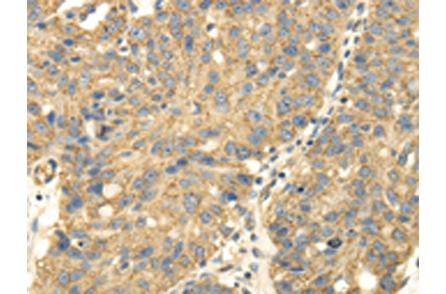Immunohistochemistry - UHRF1BP1 Antibody from Signalway Antibody (43177) - Antibodies.com