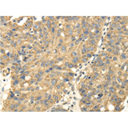 Immunohistochemistry - UHRF1BP1 Antibody from Signalway Antibody (43177) - Antibodies.com