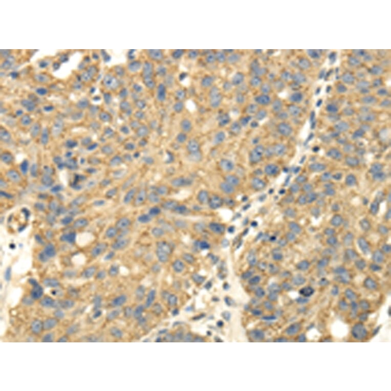 Immunohistochemistry - UHRF1BP1 Antibody from Signalway Antibody (43177) - Antibodies.com